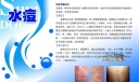 预防水痘板报展板设计图