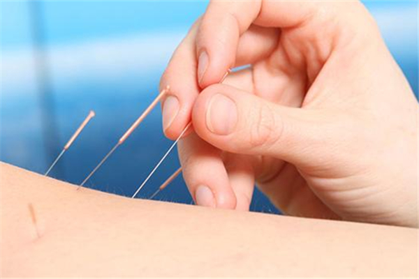 针灸要扎多久 针灸要注意哪些事项 针灸要扎多久 针灸要注意哪些事项