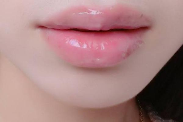 丰唇可以吃消炎药吗 丰唇吃什么食物 丰唇可以吃消炎药吗 丰唇吃什么食物