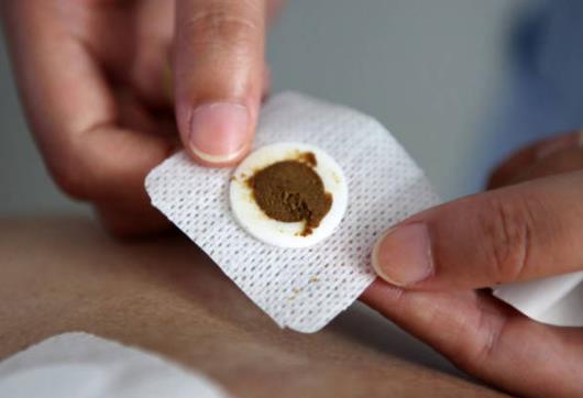 80多岁的人能贴三伏贴吗?三伏贴贴在身上很难撕下来怎么办