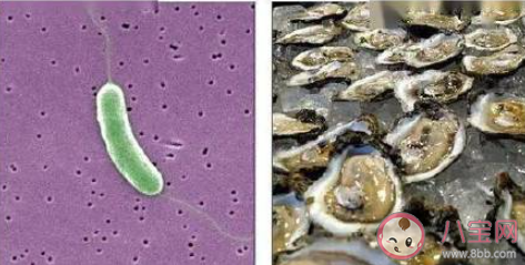 为什么被海鲜扎手可能丧命 被海鲜扎伤后该怎么办 为什么被海鲜扎手可能丧命 被海鲜扎伤后该怎么办