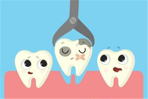 补牙前封牙是什么意思 补牙前为什么要塞药一个星期 补牙前封牙是什么意思 补牙前为什么要塞药一个星期