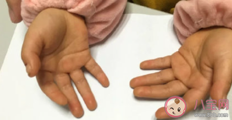 橘子一天最多吃几个 橘子吃多了会怎样 橘子一天最多吃几个 橘子吃多了会怎样