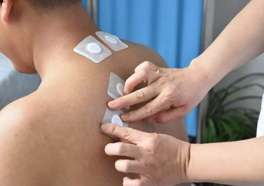 三伏贴干了加什么可以再用?哪里有卖三伏贴?