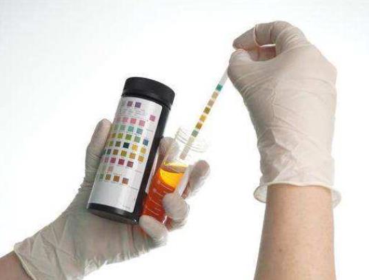 有人尿酸高几十年都没事是真的吗?尿酸高的人寿命都短吗