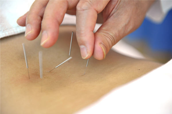 针灸会痛吗 针灸有多疼 针灸会痛吗 针灸有多疼