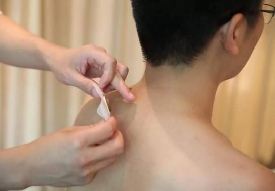 三伏贴干了加什么可以再用?哪里有卖三伏贴?