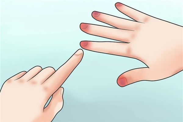 冻疮可以涂红霉素软膏吗 冻疮涂芦荟胶有用吗 冻疮可以涂红霉素软膏吗 冻疮涂芦荟胶有用吗