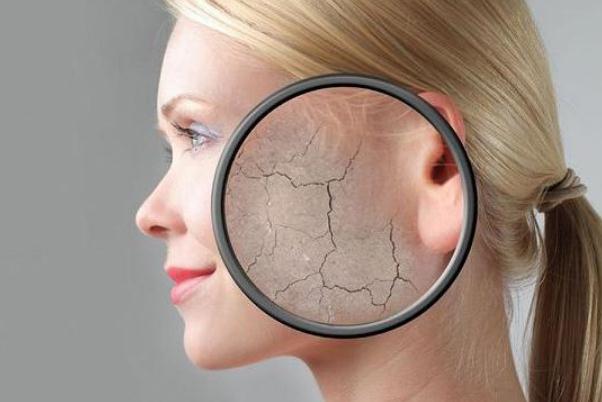 皮肤干燥怎样治疗 皮肤干燥缺什么维生素