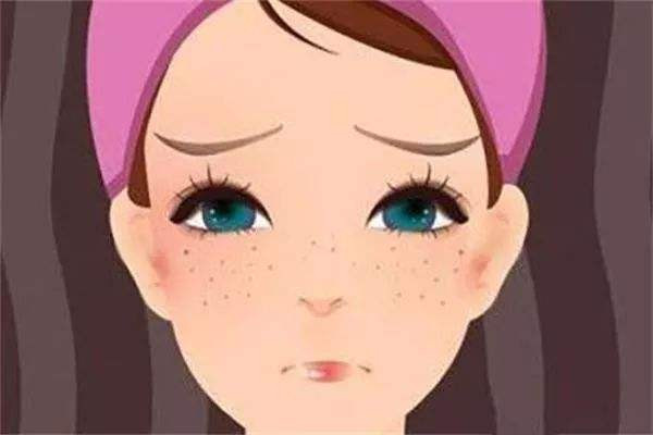 黄褐斑会不会传染 黄褐斑会不会越来越严重