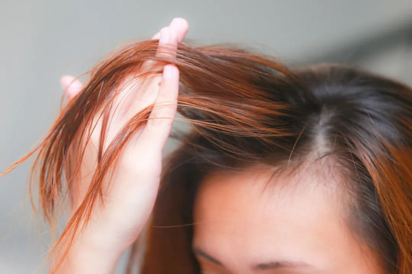 头发细软怎么改善 头发细软适合烫发吗 头发细软怎么改善 头发细软适合烫发吗