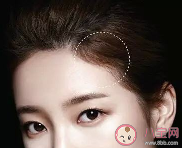 经常扎头发发际线会变高吗 为什么发际线会变高 经常扎头发发际线会变高吗 为什么发际线会变高