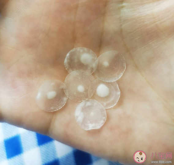 痘痘贴对痘痘有用吗 痘痘贴的作用是什么 痘痘贴对痘痘有用吗 痘痘贴的作用是什么