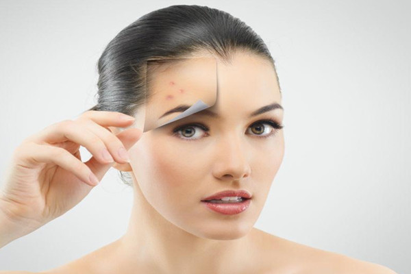 有粉刺可以化妆吗 有粉刺可以刷酸吗 有粉刺可以化妆吗 有粉刺可以刷酸吗