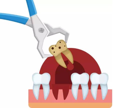 拔牙后一定要冷敷吗?拔牙后吃鸡蛋会发炎化脓吗