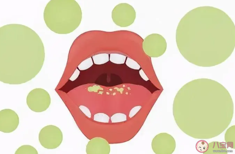 起床时为什么容易口臭 导致口臭的原因有哪些 起床时为什么容易口臭 导致口臭的原因有哪些