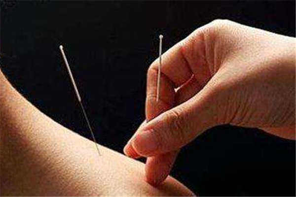 针灸的功效和作用 针灸是什么感觉 针灸的功效和作用 针灸是什么感觉