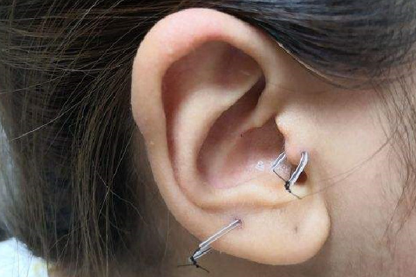 打耳骨要多久恢复期 打耳骨钉之后多久可以换耳钉 打耳骨要多久恢复期 打耳骨钉之后多久可以换耳钉