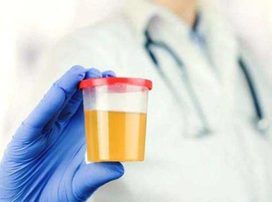 尿酸550不吃药能降回正常值吗?年轻人尿酸长期500左右严重吗