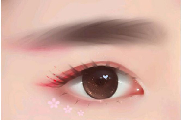 开眼角后多久能化妆 开眼角后几天拆线 开眼角后多久能化妆 开眼角后几天拆线