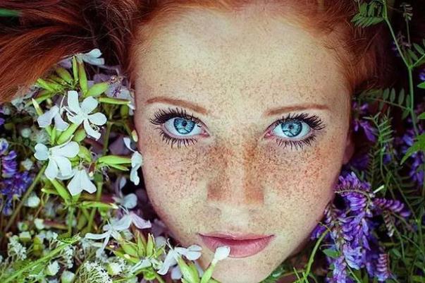 雀斑去除一般要多少钱 雀斑和黄褐斑有什么区别 雀斑去除一般要多少钱 雀斑和黄褐斑有什么区别