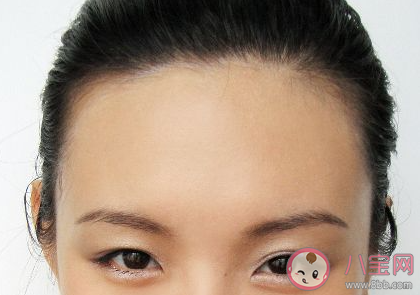 经常扎头发发际线会变高吗 为什么发际线会变高 经常扎头发发际线会变高吗 为什么发际线会变高