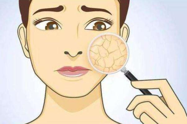 皮肤干燥脱皮严重像鱼鳞怎么办 皮肤干燥起皮像鱼鳞是怎么回事 皮肤干燥脱皮严重像鱼鳞怎么办 皮肤干燥起皮像鱼鳞是怎么回事