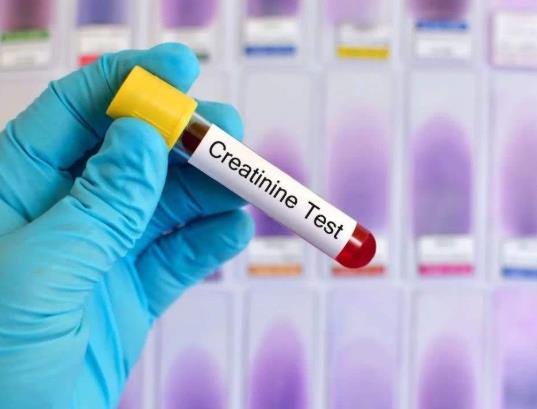 尿酸偏高会影响入编体检吗?尿酸高会引起痛风吗