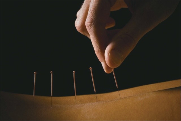 针灸要扎多久 针灸要注意哪些事项 针灸要扎多久 针灸要注意哪些事项