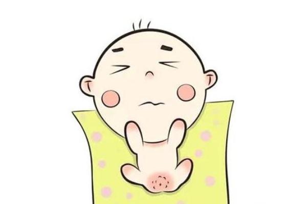 尿布疹是什么原因引起的 尿布疹是过敏吗 尿布疹是什么原因引起的 尿布疹是过敏吗
