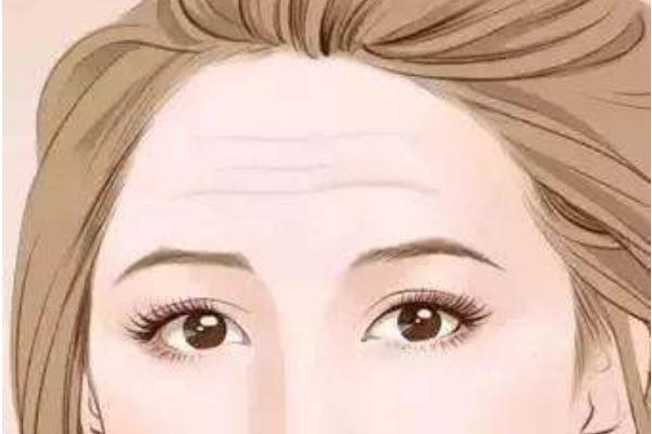 抬头纹怎么形成的原因 抬头纹怎么消除效果最好 抬头纹怎么形成的原因 抬头纹怎么消除效果最好