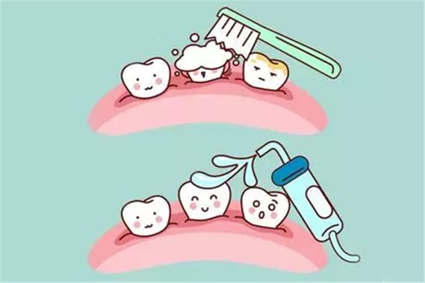 洗牙有必要洗牙根内部吗 洗牙洗的是什么 洗牙有必要洗牙根内部吗 洗牙洗的是什么