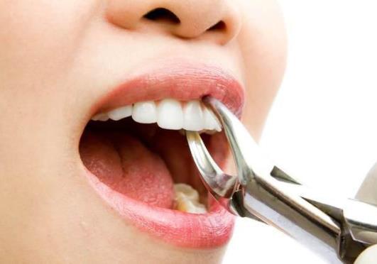 拔牙后脸肿了睡觉往哪个方向?拔牙后脸肿睡觉该怎么躺