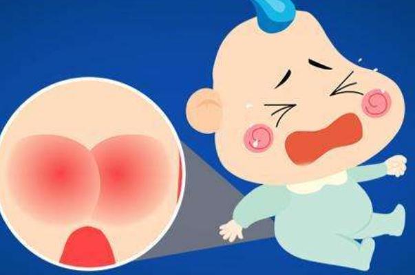 尿布疹是什么原因引起的 尿布疹是过敏吗 尿布疹是什么原因引起的 尿布疹是过敏吗