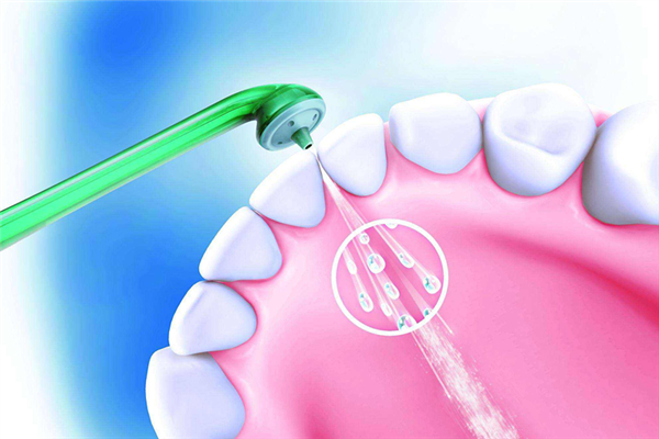 洗牙是挂什么科 洗牙用什么洗的干净